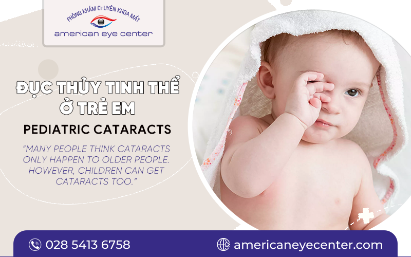 PEDIATRIC CATARACTS