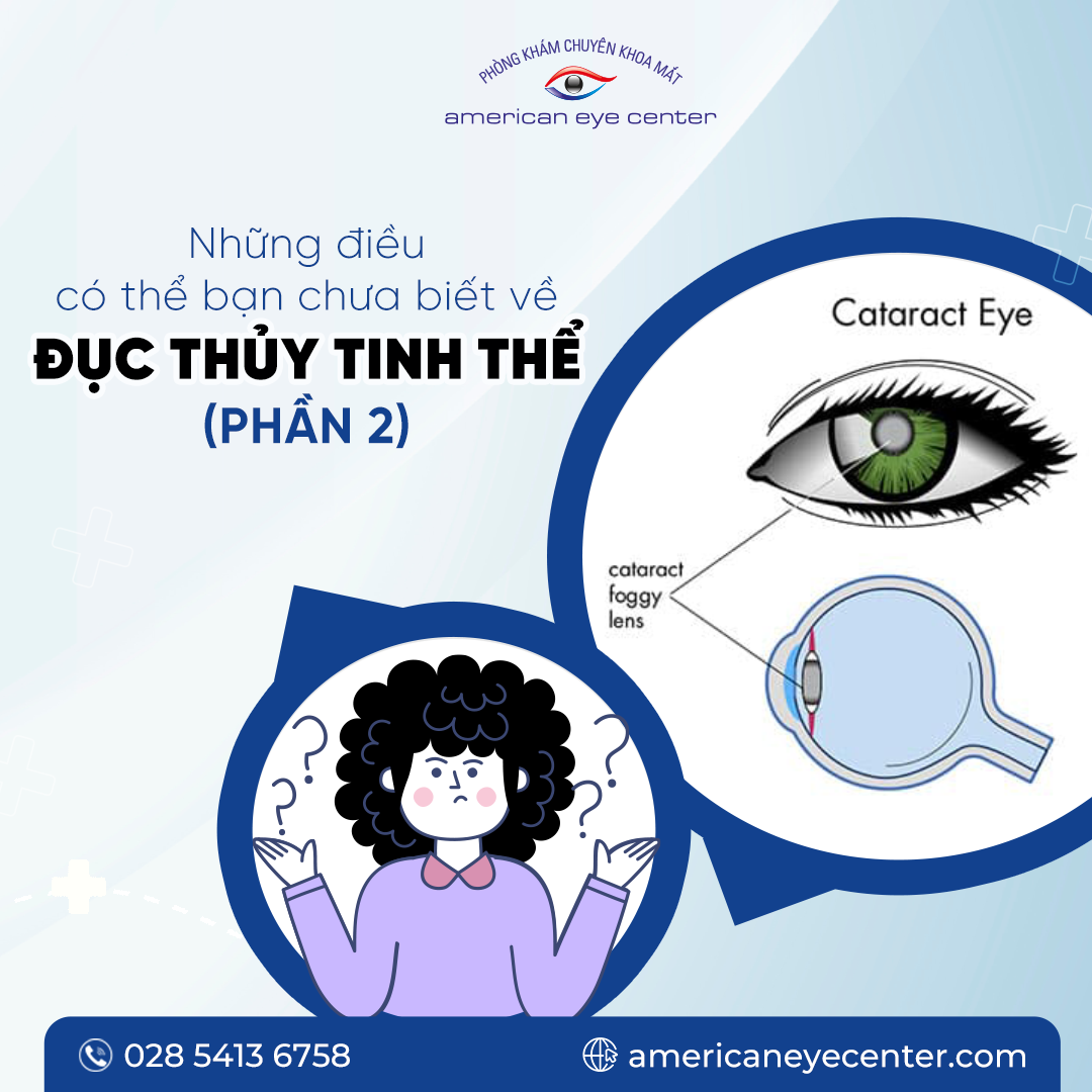 đục thủy tinh thể